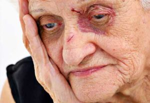 Nursing Home Abuse
